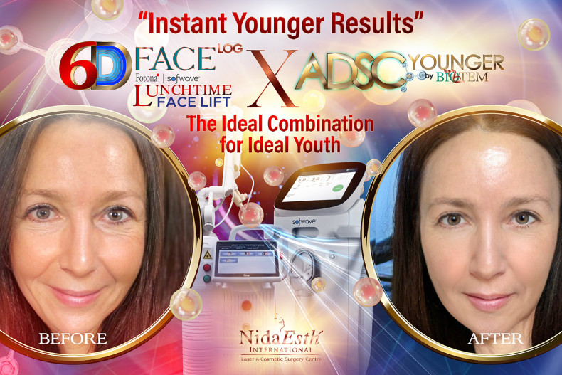 Instant Younger Face within 2 days in BKK! Possible??