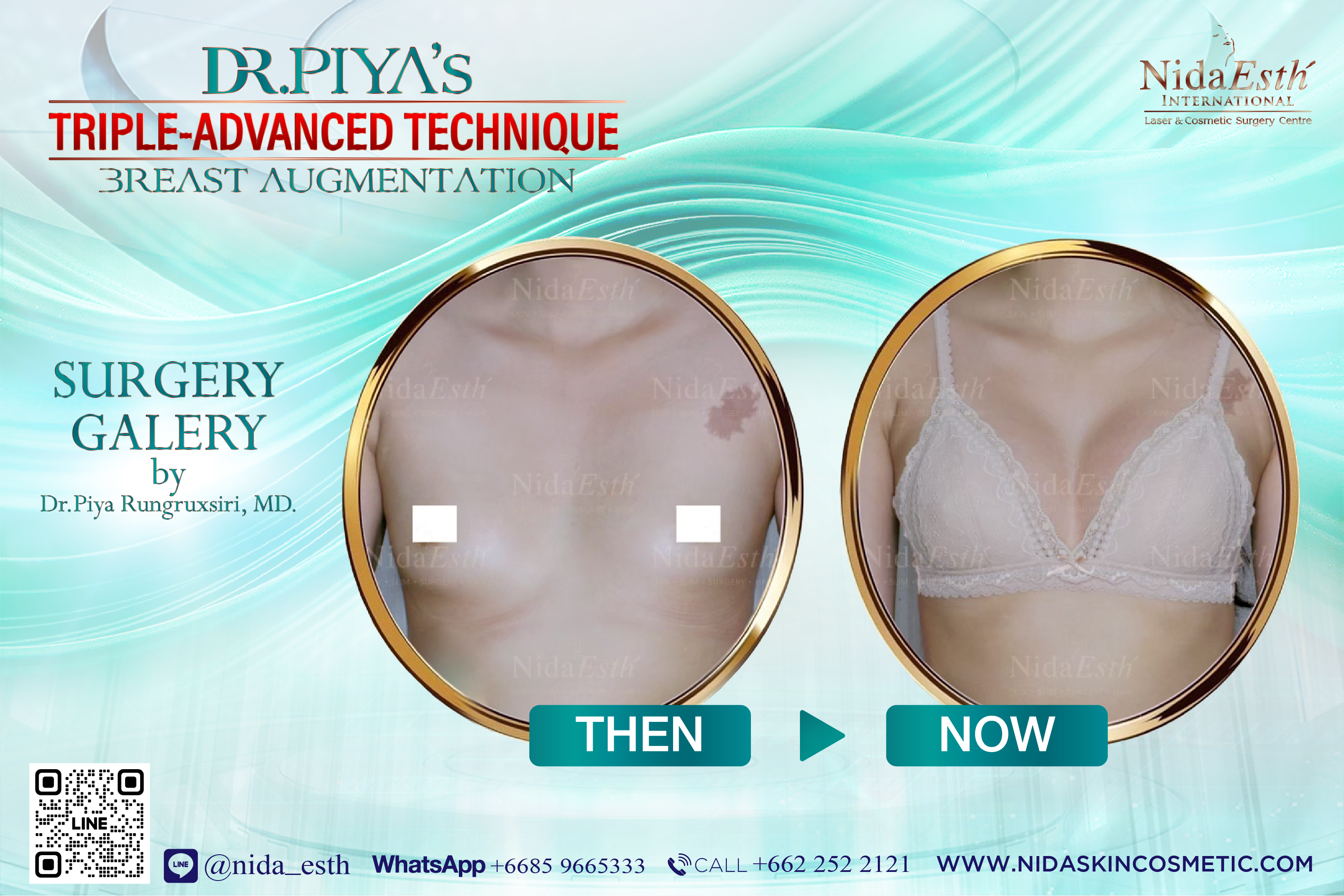 BA Dr.Piya, Breast, Surgery, Advanced Technique