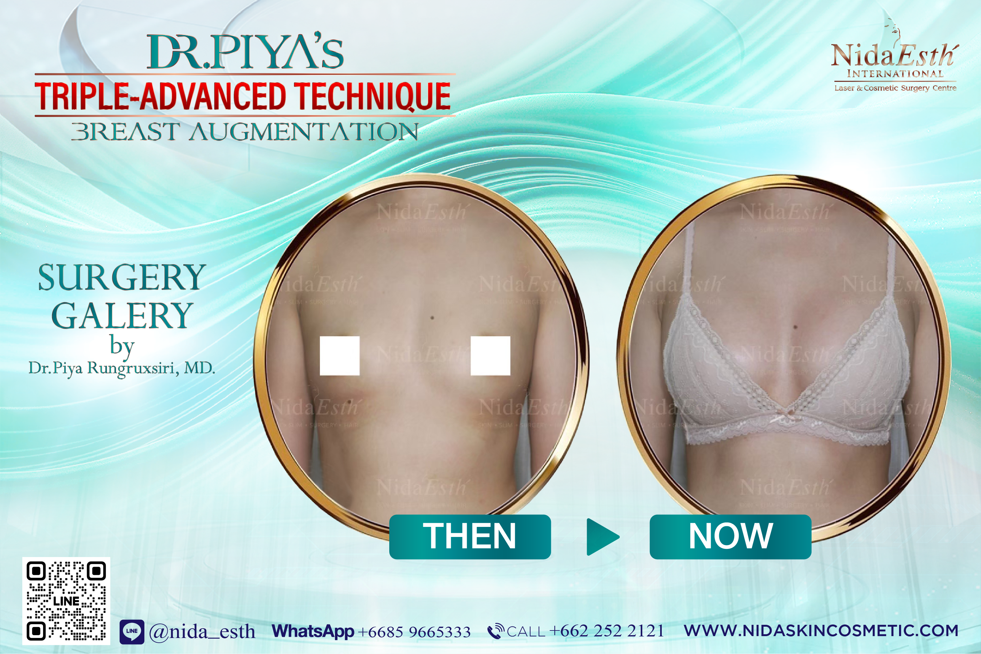 BA Dr.Piya, Breast, Surgery, Advanced Technique