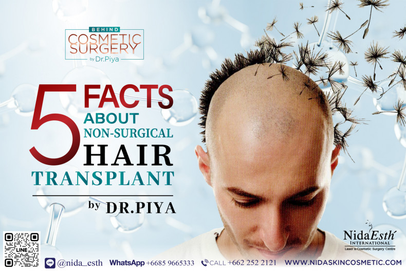 5-facts-about-non-surgical-hair-transplant-by-dr-piya