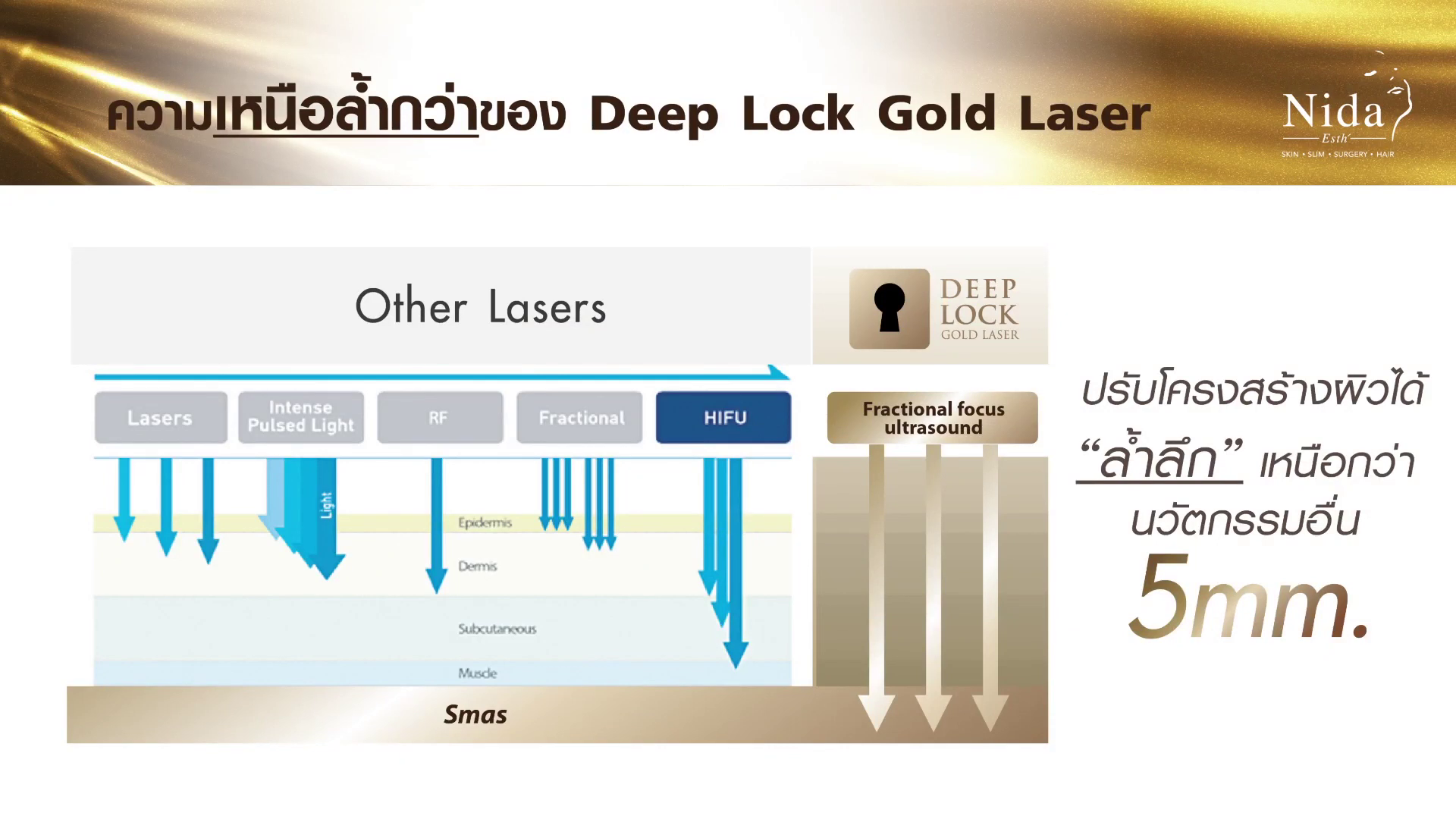 Deep Lock Gold Laser